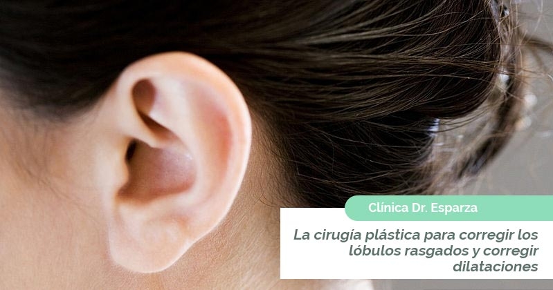 Cirugía plástica en Valencia para la reconstrucción de lóbulos rasgados, a causa de las dilataciones u otras causas
