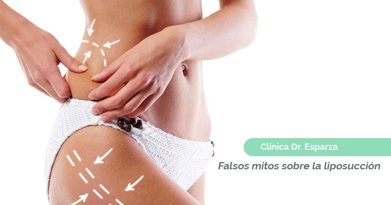 Falsos mitos sobre la liposucción