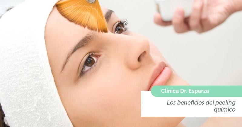 Peeling facial en Valencia