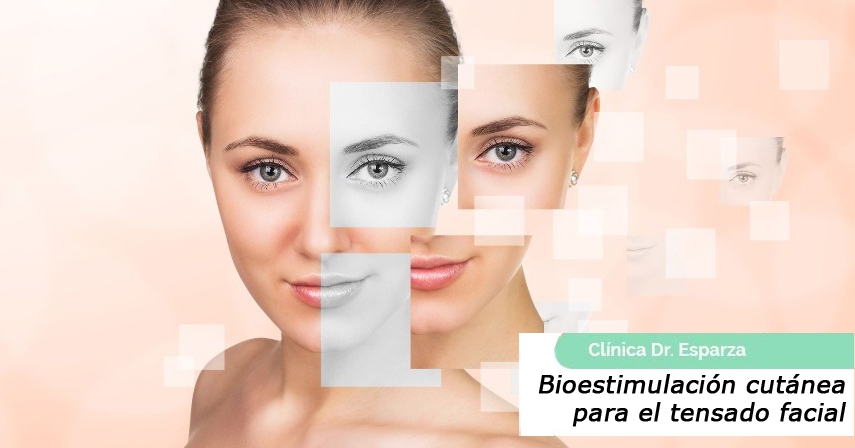 Bioestimulación cutánea