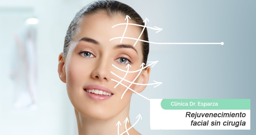 rejuvenecimiento facial sin cirugía
