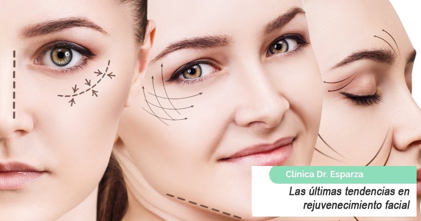 rejuvenecimiento facial