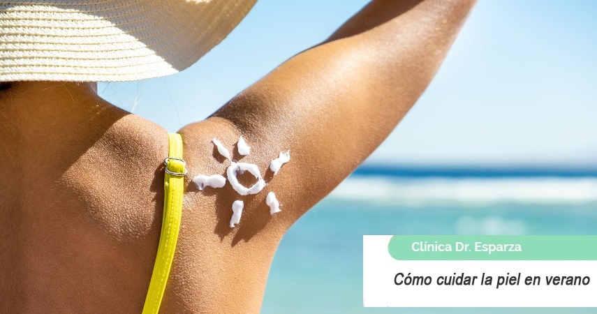 Cómo cuidar la piel en verano