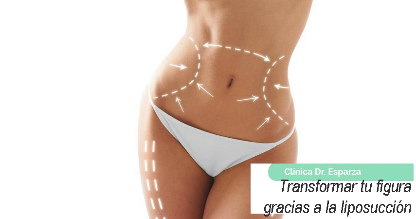 Transformar tu figura gracias a la liposucción