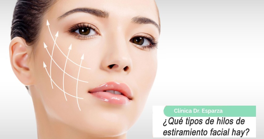 Que tipos de hilos de estiramiento hay