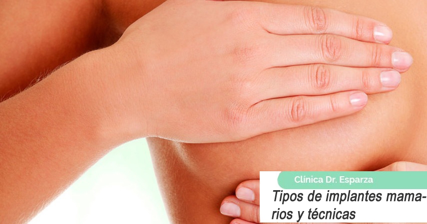 Principales tipos de implantes y técnicas de colocación