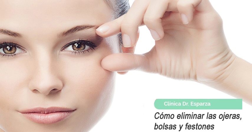 Cómo eliminar las ojeras, bolsas y festones