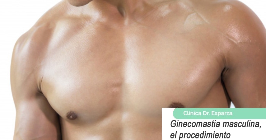 Ginecomastia masculina, el procedimiento