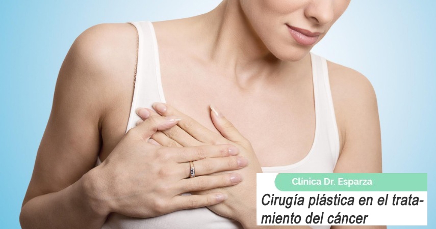Cirugía plastica para el tratamiento del cáncer