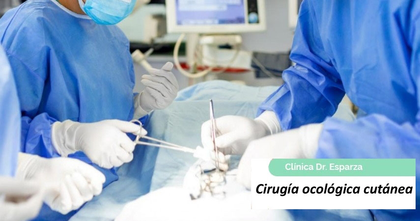 Cirugía oncológica cutánea