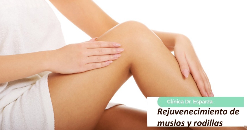 Rejuvenecimiento de Muslos y de Rodillas