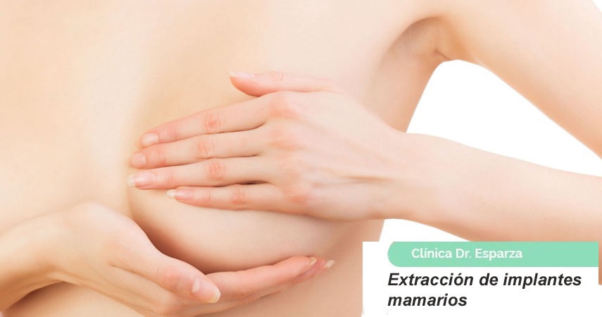 Extracción de implantes mamarios