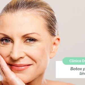 Imagen Botox para las arrugas y líneas de expresión