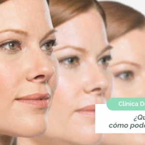 Imagen Qué es la papada y cómo podemos eliminarla?