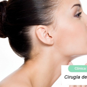 Imagen Cirugía del doble mentón o papada