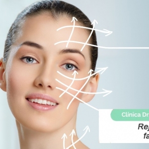 Imagen Rejuvenecimiento facial sin cirugía