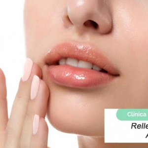Imagen Modelado de labios con Ácido Hialurónico
