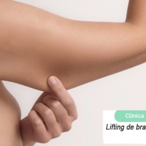 Imagen Cirugía plástica de brazos o braquioplastia (Parte 2)