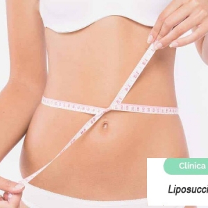 Imagen Liposucción, la guía definitiva