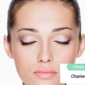 Imagen Otoplastia, Cirugía de orejas