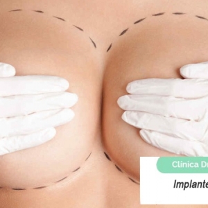 Imagen Implantes mamarios, tipos y procedimientos