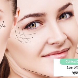 Imagen Las últimas tendencias para el rejuvenecimiento facial