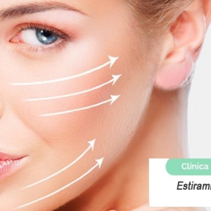 Imagen Estiramiento facial con hilo 