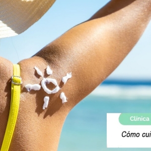 Imagen ¿Cómo cuidar la piel en verano?