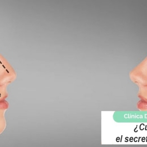 Imagen ¿Cuál es realmente el secreto de la belleza?