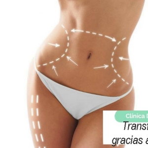 Imagen Transforma tu silueta gracias a la liposucción