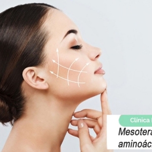Imagen Qué es la mesoterapia facial: vitaminas y aminoácidos en la cara.
