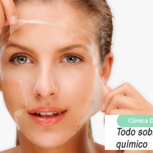 Imagen Todo sobre los peelings químicos