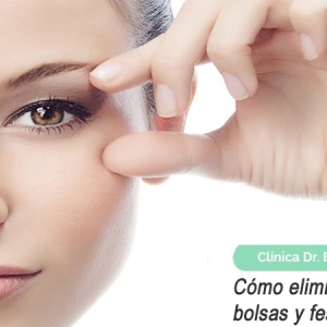 Imagen Como eliminar las ojeras, bolsas y festones