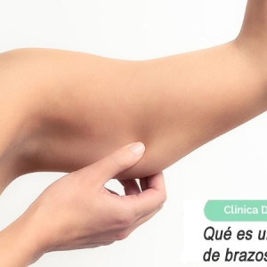 Imagen Qué es un estiramiento de brazos. Braquioplastia