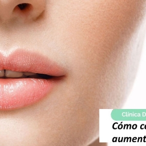 Imagen Cómo corregir los aumentos de labios