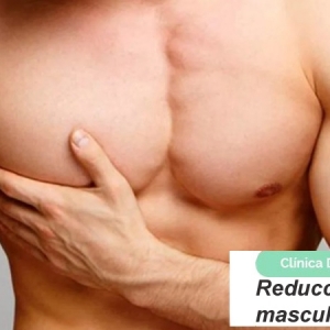 Reducción de senos masculinos