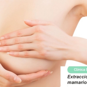 Extracción de implantes mamarios